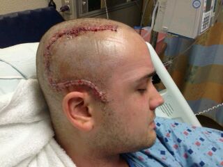 Jeremy's Story: Becoming a Warrior for Personal Fitness - Surgery